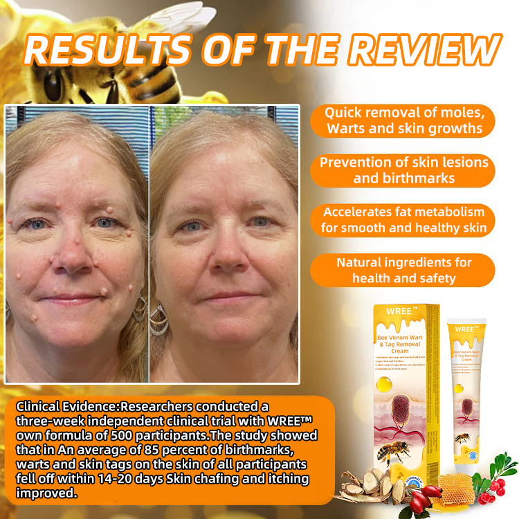 💎WREE™ Bee Venom Wart & Tag Removal Cream(👨⚕Suitable for all skin types)🐝(🔥Last day promotion 60% off)
