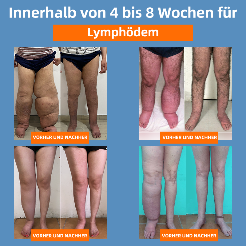 đ RFMediTherm⢠Radiofrequente Kräuter-Thermo-Kniebandage(Von RKI-Experten empfohlen - Geeignet fĂźr alle Beinleiden)