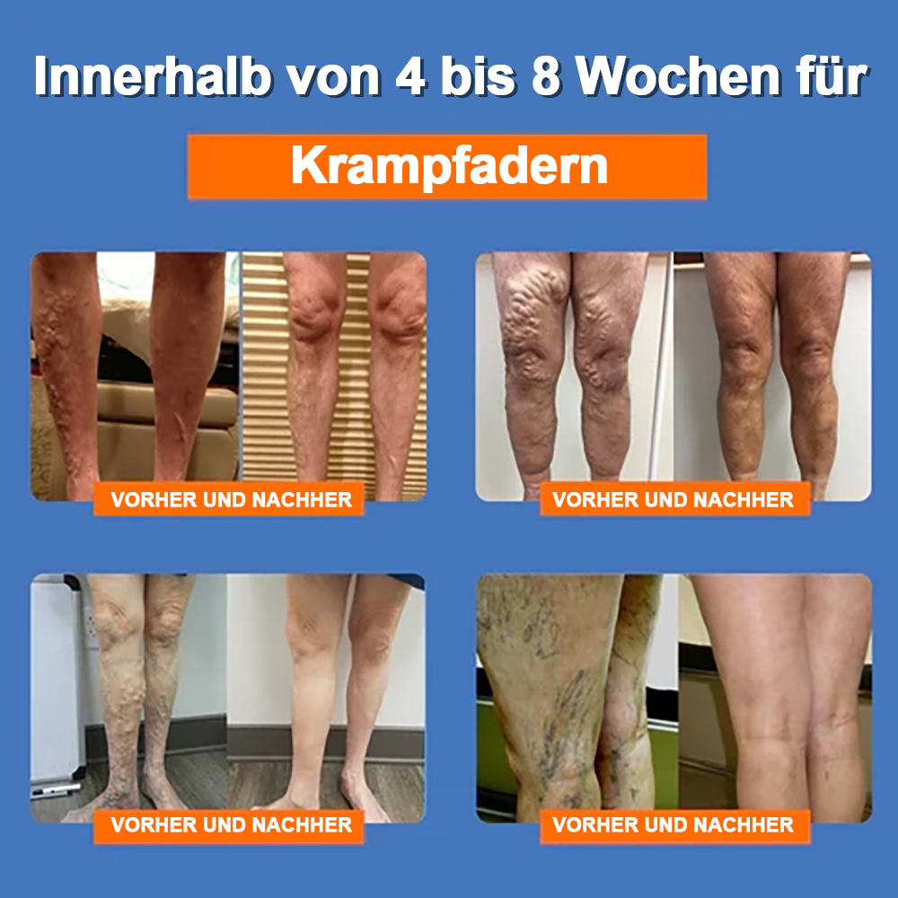 đ RFMediTherm⢠Radiofrequente Kräuter-Thermo-Kniebandage(Von RKI-Experten empfohlen - Geeignet fĂźr alle Beinleiden)