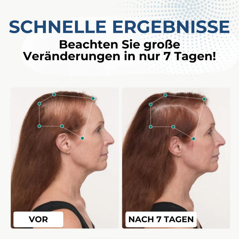 Oyikey™ Haarwuchs Kapseln - 💥Warten Sie nicht! Das Angebot endet in 10 Min.! Sichern Sie sich jetzt!