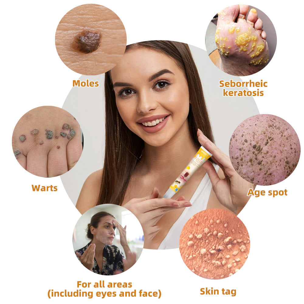 💎WREE™ Bee Venom Wart & Tag Removal Cream(👨⚕Suitable for all skin types)🐝(🔥Last day promotion 60% off)