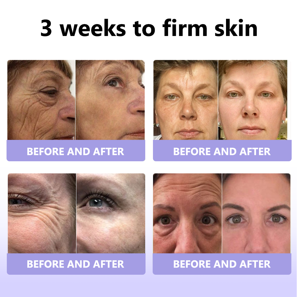 Oyikey™ Supreme Collagen Firming Cream (🔥70% Off for a Limited Time )💋