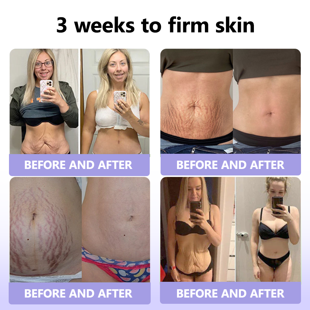 Oyikey™ Supreme Collagen Firming Cream (🔥70% Off for a Limited Time )💋