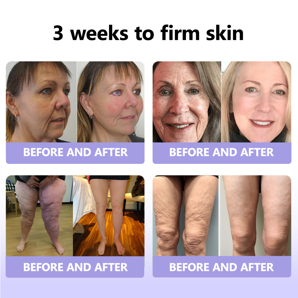 Oyikey™ Supreme Collagen Firming Cream (🔥70% Off for a Limited Time )💋