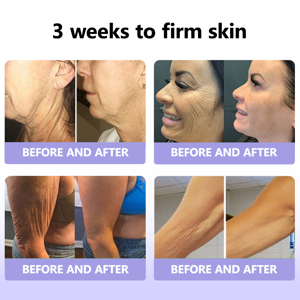 Oyikey™ Supreme Collagen Firming Cream (🔥70% Off for a Limited Time )💋