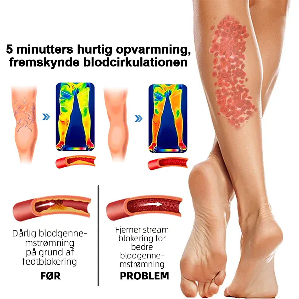 đ RFMediTherm⢠Radiofrequente Kräuter-Thermo-Kniebandage(Von RKI-Experten empfohlen - Geeignet fĂźr alle Beinleiden)