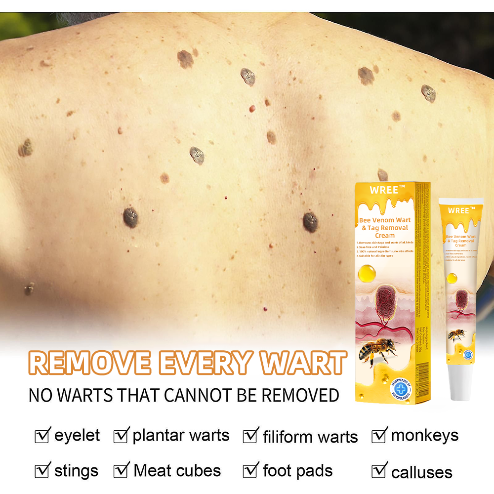 💎WREE™ Bee Venom Wart & Tag Removal Cream(👨⚕Suitable for all skin types)🐝(🔥Last day promotion 60% off)