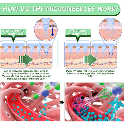 [See results in 7 days]👨‍⚕️Oyikey®SMGT-GLP-1 Nano Microneedle Patch（Painless, long-lasting, addressing diabetes, obesity, and cardiovascular diseases）💝
