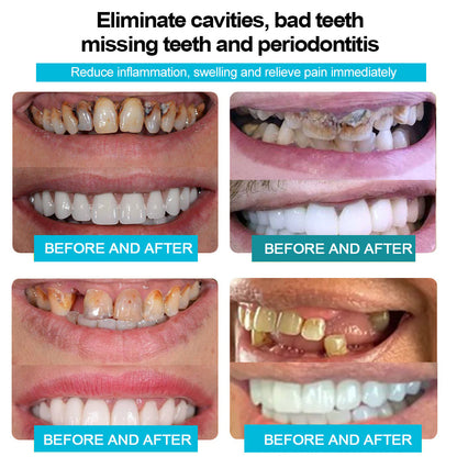 🦷🍃Bearnica™ 𝐒𝐢𝐥𝐢𝐜𝐨𝐧𝐞 𝐑𝐞𝐥𝐢𝐧𝐞 𝐃𝐞𝐧𝐭𝐮𝐫𝐞 𝐒𝐞𝐭 (⏰𝐋𝐢𝐦𝐢𝐭𝐞𝐝 𝐭𝐢𝐦𝐞 𝐝𝐢𝐬𝐜𝐨𝐮𝐧𝐭 𝐋𝐚𝐬𝐭 𝟑𝟎 𝐦𝐢𝐧𝐮𝐭𝐞𝐬⏰)