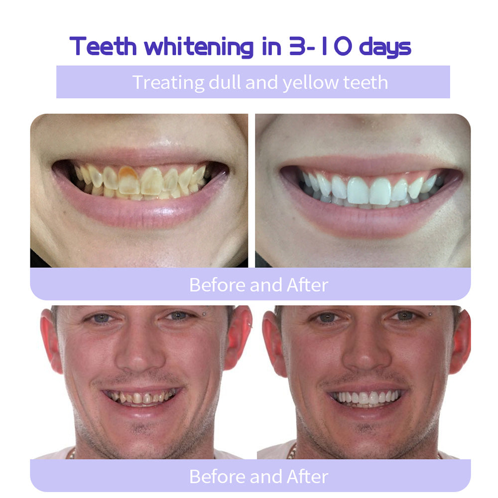 𝐎𝐲𝐢𝐤𝐞𝐲® 𝐓𝐞𝐞𝐭𝐡 𝐑𝐞𝐬𝐭𝐨𝐫𝐚𝐭𝐢𝐨𝐧 𝐌𝐢𝐧𝐞𝐫𝐚𝐥 𝐏𝐨𝐰𝐝𝐞𝐫 👩‍⚕️𝐑𝐞𝐜𝐨𝐦𝐦𝐞𝐧𝐝𝐞𝐝 𝐛𝐲 𝐭𝐡𝐞 𝐁𝐫𝐢𝐭𝐢𝐬𝐡 𝐃𝐞𝐧𝐭𝐚𝐥 𝐀𝐬𝐬𝐨𝐜𝐢𝐚𝐭𝐢𝐨𝐧(𝐁𝐃𝐀)(🔥🔥𝑳𝒂𝒔𝒕 𝒅𝒂𝒚 𝒑𝒓𝒐𝒎𝒐𝒕𝒊𝒐𝒏 𝟕𝟓% 𝒐𝒇𝒇🔥🔥)🪻