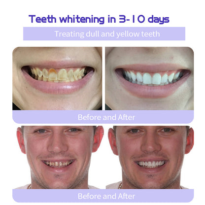 𝐎𝐲𝐢𝐤𝐞𝐲® 𝐓𝐞𝐞𝐭𝐡 𝐑𝐞𝐬𝐭𝐨𝐫𝐚𝐭𝐢𝐨𝐧 𝐌𝐢𝐧𝐞𝐫𝐚𝐥 𝐏𝐨𝐰𝐝𝐞𝐫 👩‍⚕️𝐑𝐞𝐜𝐨𝐦𝐦𝐞𝐧𝐝𝐞𝐝 𝐛𝐲 𝐭𝐡𝐞 𝐁𝐫𝐢𝐭𝐢𝐬𝐡 𝐃𝐞𝐧𝐭𝐚𝐥 𝐀𝐬𝐬𝐨𝐜𝐢𝐚𝐭𝐢𝐨𝐧(𝐁𝐃𝐀)(🔥🔥𝑳𝒂𝒔𝒕 𝒅𝒂𝒚 𝒑𝒓𝒐𝒎𝒐𝒕𝒊𝒐𝒏 𝟕𝟓% 𝒐𝒇𝒇🔥🔥)🪻