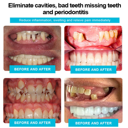 🦷🍃Bearnica™ 𝐒𝐢𝐥𝐢𝐜𝐨𝐧𝐞 𝐑𝐞𝐥𝐢𝐧𝐞 𝐃𝐞𝐧𝐭𝐮𝐫𝐞 𝐒𝐞𝐭 (⏰𝐋𝐢𝐦𝐢𝐭𝐞𝐝 𝐭𝐢𝐦𝐞 𝐝𝐢𝐬𝐜𝐨𝐮𝐧𝐭 𝐋𝐚𝐬𝐭 𝟑𝟎 𝐦𝐢𝐧𝐮𝐭𝐞𝐬⏰)