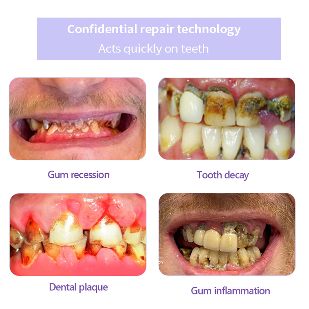 𝐎𝐲𝐢𝐤𝐞𝐲® 𝐓𝐞𝐞𝐭𝐡 𝐑𝐞𝐬𝐭𝐨𝐫𝐚𝐭𝐢𝐨𝐧 𝐌𝐢𝐧𝐞𝐫𝐚𝐥 𝐏𝐨𝐰𝐝𝐞𝐫 👩‍⚕️𝐑𝐞𝐜𝐨𝐦𝐦𝐞𝐧𝐝𝐞𝐝 𝐛𝐲 𝐭𝐡𝐞 𝐁𝐫𝐢𝐭𝐢𝐬𝐡 𝐃𝐞𝐧𝐭𝐚𝐥 𝐀𝐬𝐬𝐨𝐜𝐢𝐚𝐭𝐢𝐨𝐧(𝐁𝐃𝐀)(🔥🔥𝑳𝒂𝒔𝒕 𝒅𝒂𝒚 𝒑𝒓𝒐𝒎𝒐𝒕𝒊𝒐𝒏 𝟕𝟓% 𝒐𝒇𝒇🔥🔥)🪻