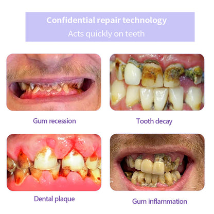 𝐎𝐲𝐢𝐤𝐞𝐲® 𝐓𝐞𝐞𝐭𝐡 𝐑𝐞𝐬𝐭𝐨𝐫𝐚𝐭𝐢𝐨𝐧 𝐌𝐢𝐧𝐞𝐫𝐚𝐥 𝐏𝐨𝐰𝐝𝐞𝐫 👩‍⚕️𝐑𝐞𝐜𝐨𝐦𝐦𝐞𝐧𝐝𝐞𝐝 𝐛𝐲 𝐭𝐡𝐞 𝐁𝐫𝐢𝐭𝐢𝐬𝐡 𝐃𝐞𝐧𝐭𝐚𝐥 𝐀𝐬𝐬𝐨𝐜𝐢𝐚𝐭𝐢𝐨𝐧(𝐁𝐃𝐀)(🔥🔥𝑳𝒂𝒔𝒕 𝒅𝒂𝒚 𝒑𝒓𝒐𝒎𝒐𝒕𝒊𝒐𝒏 𝟕𝟓% 𝒐𝒇𝒇🔥🔥)🪻