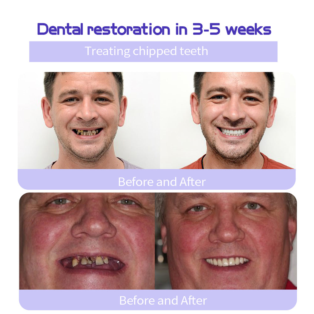 𝐎𝐲𝐢𝐤𝐞𝐲® 𝐓𝐞𝐞𝐭𝐡 𝐑𝐞𝐬𝐭𝐨𝐫𝐚𝐭𝐢𝐨𝐧 𝐌𝐢𝐧𝐞𝐫𝐚𝐥 𝐏𝐨𝐰𝐝𝐞𝐫 👩‍⚕️𝐑𝐞𝐜𝐨𝐦𝐦𝐞𝐧𝐝𝐞𝐝 𝐛𝐲 𝐭𝐡𝐞 𝐁𝐫𝐢𝐭𝐢𝐬𝐡 𝐃𝐞𝐧𝐭𝐚𝐥 𝐀𝐬𝐬𝐨𝐜𝐢𝐚𝐭𝐢𝐨𝐧(𝐁𝐃𝐀)(🔥🔥𝑳𝒂𝒔𝒕 𝒅𝒂𝒚 𝒑𝒓𝒐𝒎𝒐𝒕𝒊𝒐𝒏 𝟕𝟓% 𝒐𝒇𝒇🔥🔥)🪻