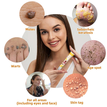 💎WREE™ Bee Venom Wart & Tag Removal Cream(👨‍⚕Suitable for all skin types)🐝(🔥Last day promotion 60% off)