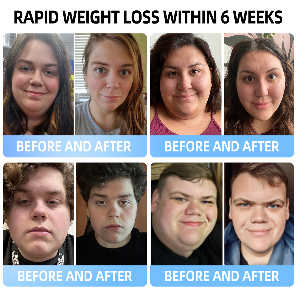 𝐒𝒑𝑧𝗏® 𝐌𝐞𝗴𝗹𝘂𝘁𝗶𝗱𝗲 𝑶𝒓𝑎𝑙 𝑳𝒊𝒒𝑢𝑖𝑑 (👨‍⚕️𝑭𝒐𝑜𝑑 Grade 𝑭𝐚𝐭 𝗕𝘂𝗿𝗻𝗲𝗿 - 𝗨𝗻𝗶𝘃𝗲𝗿𝘀𝗶𝘁𝘆 𝗼𝗳 𝗚𝗹𝗮𝘀𝗴𝗼𝘄 𝗥&𝗗 🎁 💝 𝖮𝗇𝖾 𝗈𝖿 𝐑𝖯𝖲'𝗌 𝗁𝗂𝗀𝗁𝗅𝗒 𝗋𝖾𝖼𝗈𝗆𝗆𝖾𝗇𝖽𝖾𝖽 𝗉𝗋𝗈𝖽𝗎𝖼𝗍𝗌 𝖿𝗈𝗋 𝟤𝟢𝟤𝟧) 💝 💝
