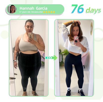[See results in 7 days]👨‍⚕️Oyikey®SMGT-GLP-1 Nano Microneedle Patch（Painless, long-lasting, addressing diabetes, obesity, and cardiovascular diseases）💝